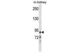 Image no. 1 for anti-Chloride Channel Kb (CLCNKB) (AA 10-40), (N-Term) antibody (ABIN951557)