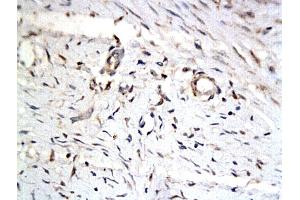 Image no. 1 for anti-Protein Phosphatase 1, Regulatory Subunit 13 Like (PPP1R13L) (AA 15-100) antibody (ABIN727280)