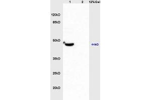 Image no. 2 for anti-Matrix Metallopeptidase 23 (MMP23) (AA 281-380) antibody (ABIN759176)