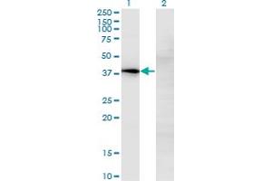 Image no. 1 for anti-Nephroblastoma Overexpressed (NOV) (AA 32-131) antibody (ABIN518411)