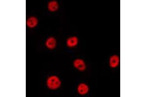 Image no. 2 for anti-Polypyrimidine Tract Binding Protein 2 (PTBP2) antibody (ABIN6264500)
