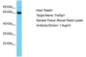 Image no. 1 for anti-TNF Receptor-Associated Factor 3 Interacting Protein 1 (TRAF3IP1) (AA 42-91) antibody (ABIN6750346)