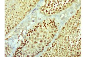 Image no. 1 for anti-NIMA (Never In Mitosis Gene A)-Related Kinase 11 (NEK11) (AA 151-250) antibody (ABIN5007392)