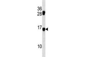 Image no. 1 for anti-MDS1 and EVI1 Complex Locus (MECOM) (AA 81-109) antibody (ABIN3031740)