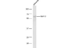 Image no. 1 for anti-Ring Finger Protein, LIM Domain Interacting (RLIM) (AA 550-600) antibody (ABIN1385938)