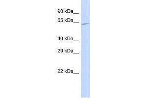 Host:  Rabbit  Target Name:  SLC25A13  Sample Type:  721_B Whole Cell lysates  Antibody Dilution:  1.
