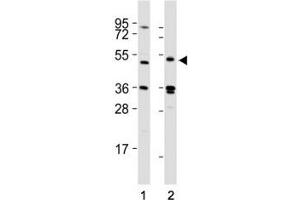 Image no. 3 for anti-Lymphocyte-Activation Gene 3 (LAG3) (AA 103-132) antibody (ABIN3028809)