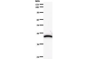 Image no. 1 for anti-HIRA Interacting Protein 3 (HIRIP3) antibody (ABIN931125)