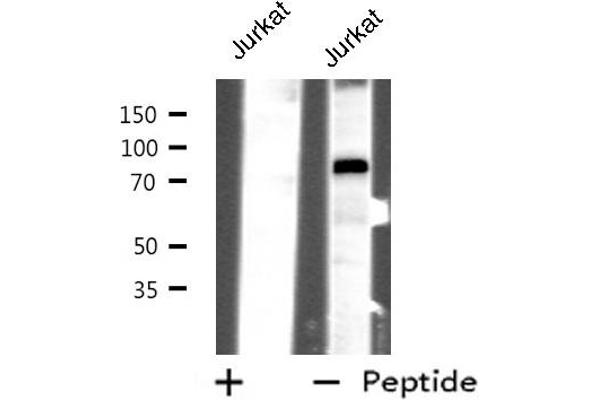 anti-Checkpoint with Forkhead and Ring Finger Domains (CHFR) antibody