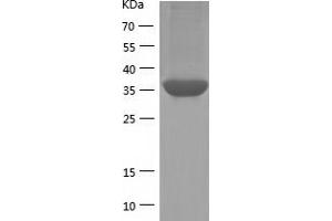 PPP1R8 Protein (AA 1-351) (His tag)
