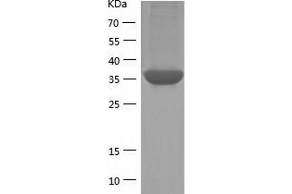 PPP1R8 Protein (AA 1-351) (His tag)