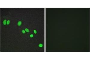 Image no. 2 for anti-Nuclear Receptor Co-Repressor 2 (NCOR2) (AA 511-560) antibody (ABIN1534223)
