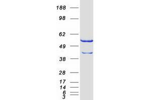 Image no. 1 for CAP, Adenylate Cyclase-Associated Protein 1 (CAP1) (Transcript Variant 1) protein (Myc-DYKDDDDK Tag) (ABIN2713108)