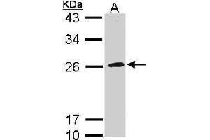 GP1BB anticorps  (Internal Region)