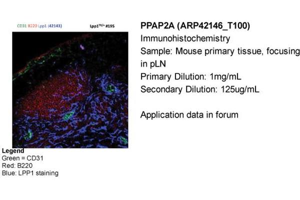 PPAP2A antibody  (Middle Region)