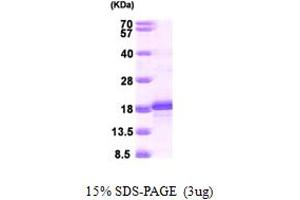 Image no. 1 for Basic Leucine Zipper ATF-like Transcription Factor (BATF) (AA 1-125) protein (His tag) (ABIN667362)