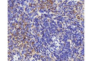 Immunohistochemistry analysis of paraffin-embedded rat thymus tissue using INPP5D Polyclonal Antibody at dilution of 1:300.