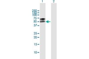 Image no. 3 for anti-Legumain (LGMN) (AA 1-433) antibody (ABIN519318)