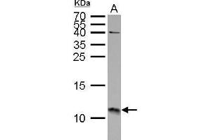 WB Image S100A11 antibody detects S100A11 protein by Western blot analysis.