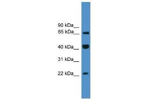 Image no. 1 for anti-Transcription Elongation Factor A (SII)-Like 6 (TCEAL6) (C-Term) antibody (ABIN2784147)