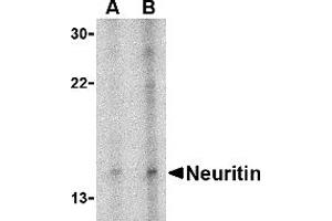 Image no. 1 for anti-Neuritin 1 (NRN1) (Middle Region) antibody (ABIN1031012)