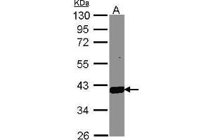 Image no. 4 for anti-Aldo-Keto Reductase Family 1, Member C3 (3-alpha Hydroxysteroid Dehydrogenase, Type II) (AKR1C3) (C-Term) antibody (ABIN2855872)