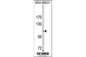 Image no. 1 for anti-Sorbin and SH3 Domain Containing 2 (Sorbs2) (AA 175-204), (N-Term) antibody (ABIN652279)