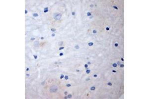 Image no. 3 for anti-Solute Carrier Family 17 (Sodium-Dependent Inorganic Phosphate Cotransporter), Member 8 (SLC17A8) (N-Term) antibody (ABIN571628)