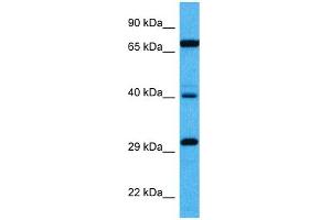 Image no. 2 for anti-Cyclin D Binding Myb-Like Transcription Factor 1 (DMTF1) (Middle Region) antibody (ABIN2776044)