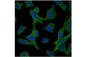 Image no. 4 for anti-Mitogen-Activated Protein Kinase Kinase 6 (MAP2K6) antibody (ABIN1108126)