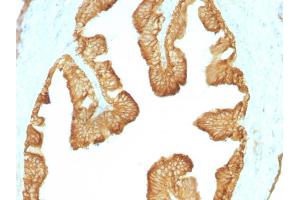 Image no. 3 for anti-Keratin 77 (KRT77) antibody (ABIN6941447)