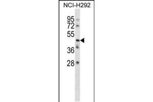 Image no. 1 for anti-Transmembrane Protein 102 (TMEM102) (AA 156-185), (N-Term) antibody (ABIN5538430)