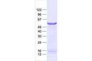 ZNF79 Protein (His tag)