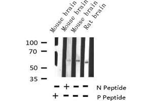 Image no. 2 for anti-Tyrosine Hydroxylase (TH) (pSer19) antibody (ABIN6255056)