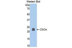 Image no. 1 for anti-Interleukin 13 Receptor, alpha 1 (IL13RA1) (AA 201-360) antibody (ABIN1859340)