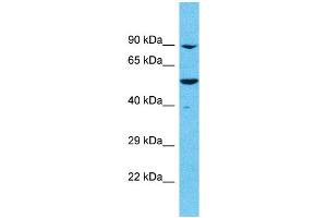 Image no. 1 for anti-Meiosis Specific with OB Domains (MEIOB) (C-Term) antibody (ABIN2786254)