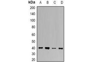 Image no. 1 for anti-Uroporphyrinogen Decarboxylase (UROD) (full length) antibody (ABIN6005168)