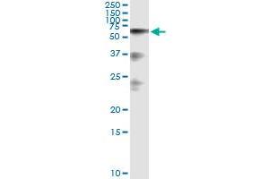 Image no. 2 for anti-Hyaluronan Binding Protein 2 (HABP2) (AA 105-204) antibody (ABIN516334)