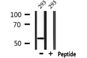 Image no. 2 for anti-Keratin 12 (KRT12) (Internal Region) antibody (ABIN6262873)