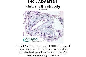 Image no. 1 for anti-ADAM Metallopeptidase with Thrombospondin Type 1 Motif, 1 (ADAMTS1) (Internal Region) antibody (ABIN1731523)