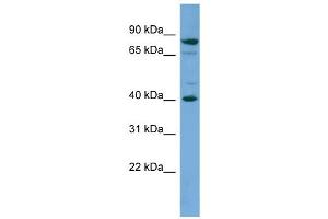 Image no. 1 for anti-Paraneoplastic Antigen MA2 (PNMA2) (Middle Region) antibody (ABIN2784877)