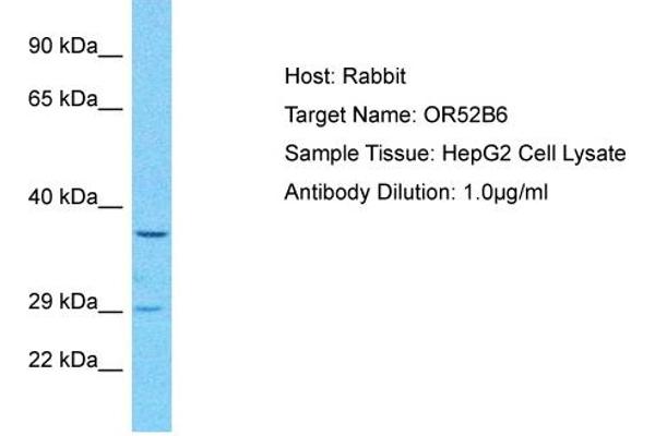 OR52B6 antibody  (C-Term)