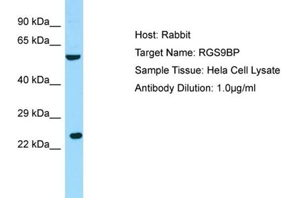 Regulator of G Protein Signaling 9 Binding Protein (RGS9BP) (N-Term) antibody
