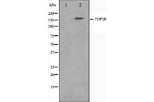 TOP2B antibody  (N-Term)