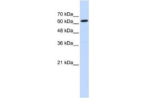 Image no. 1 for anti-Eukaryotic Translation Initiation Factor 2D (EIF2D) (Middle Region) antibody (ABIN2779012)