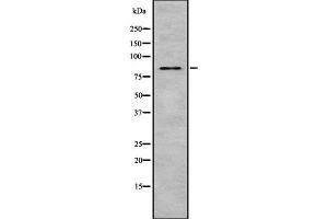 Image no. 3 for anti-Macrophage Stimulating 1 (Hepatocyte Growth Factor-Like) (MST1) antibody (ABIN6263402)