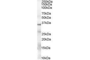Image no. 10 for anti-Glyceraldehyde-3-Phosphate Dehydrogenase (GAPDH) (Internal Region) antibody (ABIN185543)