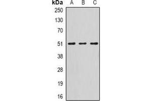 Image no. 3 for anti-serpin Peptidase Inhibitor, Clade A (Alpha-1 Antiproteinase, Antitrypsin), Member 10 (SERPINA10) antibody (ABIN3198311)