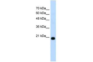 Image no. 2 for anti-F-Box Protein 25 (FBXO25) (C-Term) antibody (ABIN629736)
