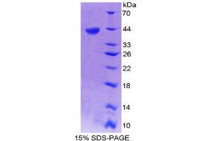Image no. 1 for Chemokine (C-X-C Motif) Ligand 14 (CXCL14) (AA 35-111) protein (His tag,GST tag) (ABIN2122511)
